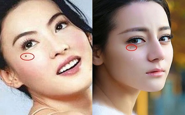 Vị trí của nốt ruồi lệ