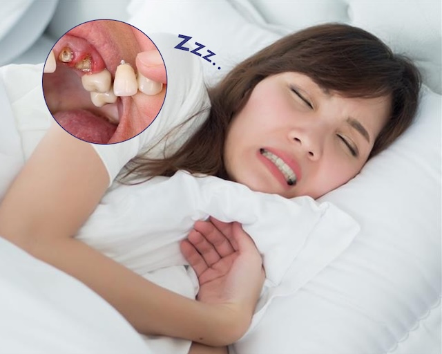 Giấc mơ lặp lại khiến bạn cảm thấy lo lắng, căng thẳng