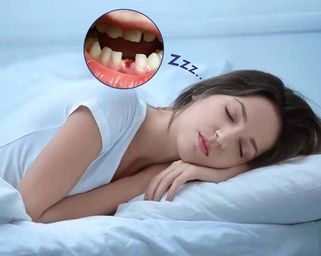 Giấc mơ thấy răng rụng cũng cho thấy những phản ứng tâm sinh lý hiện tại của cơ thể